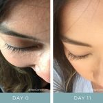 Before + After - Lash Loss