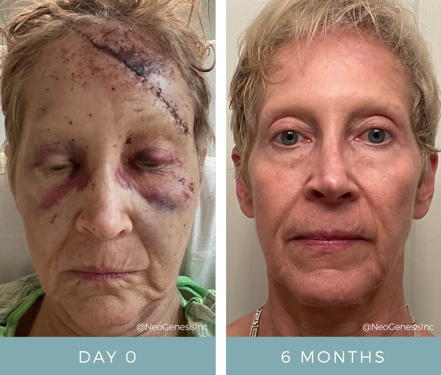 Before + After - Post surgery skin care products support the healing process