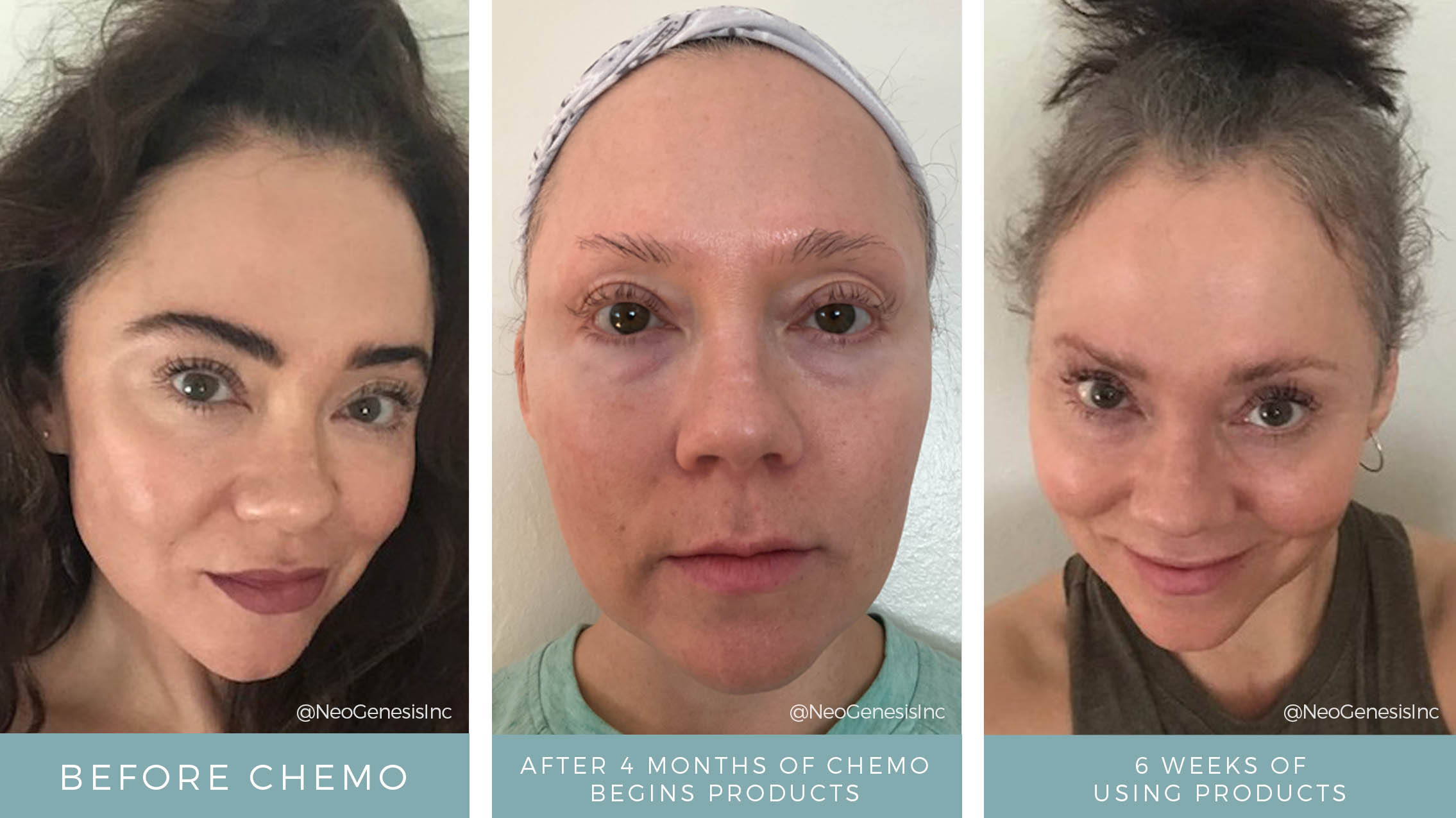 Before + After - Hair + Lash + Brow Loss from Chemo